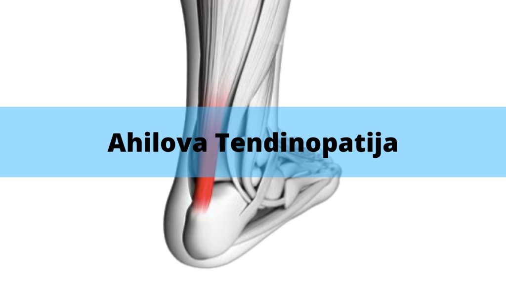 Ahilova Tendinopatija